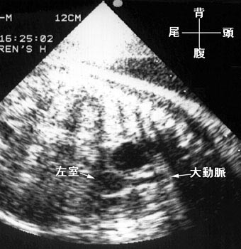 胎児心エコー検査図：図に続いて説明文