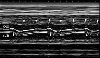 エコー検査図：図に続いて説明文