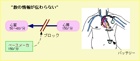 数の情報が伝わらない：イラストに続いて説明文