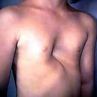 6歳男児 手術前