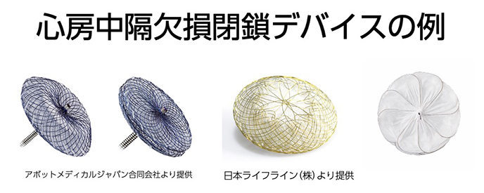 心房中隔欠損閉鎖デバイスの例