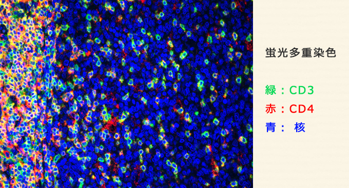 蛍光多重染色　緑：CD3　赤：CD4　青：核