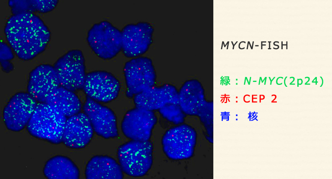 MYCN-FISH　緑：N-MYC（2p24）赤：CEP 2　青：核