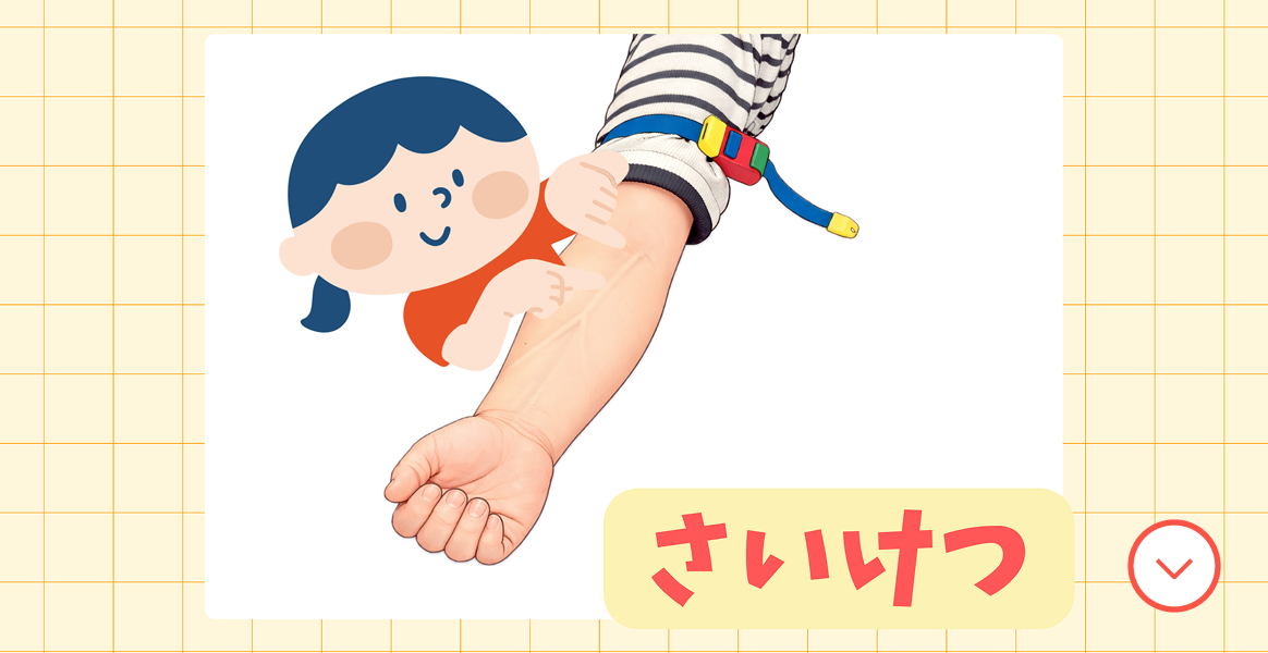 さいけつ