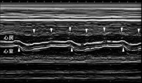 エコー検査図：図に続いて説明文