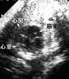 胎児心エコー検査図：図に続いて説明文