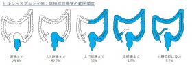 ヒルシュ範囲