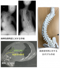 Neuromuscular