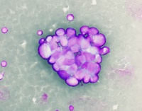Giemsa