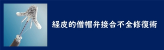 経皮的僧帽弁接合不全修復術