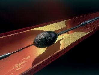 ロータブレーター:先端にダイヤモンドの粉が付いており、毎分14-23万回転しながら進むことにより硬いプラーク(粥腫)を切除します。(© 2019 Boston Scientific Corporation. All rights reserved.)