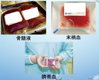 骨髄液、末梢決、臍帯血の画像