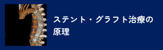 ステント・グラフト治療の原理