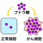 .がん細胞は正常細胞より高率にブドウ糖を摂取します。