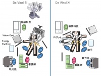 「当院におけるロボット支援下胃切除術」