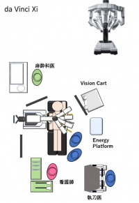 「当院におけるロボット支援下食道亜全摘術」