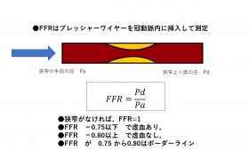 FFR