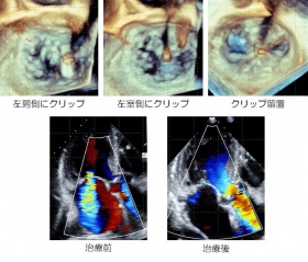 ハイブリッド手術室